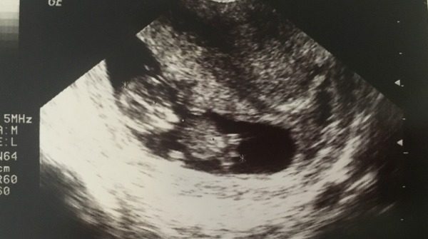 Baby Announcement